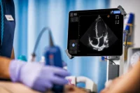 POCUS poster